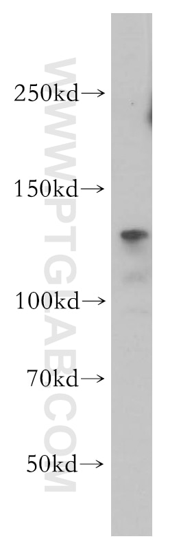 Integrin Beta 1 Polyclonal antibody
