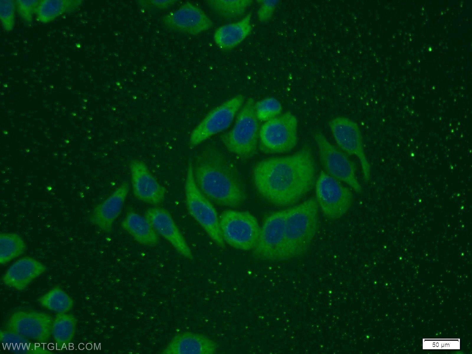 Immunofluorescence (IF) / fluorescent staining of PC-3 cells using ITGB1BP1 Polyclonal antibody (12300-1-AP)