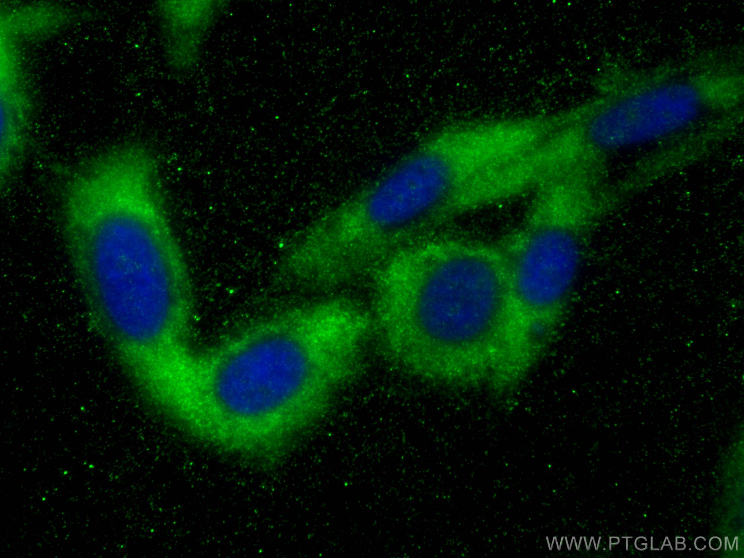 Immunofluorescence (IF) / fluorescent staining of PC-3 cells using ITGB1BP1 Polyclonal antibody (12300-1-AP)