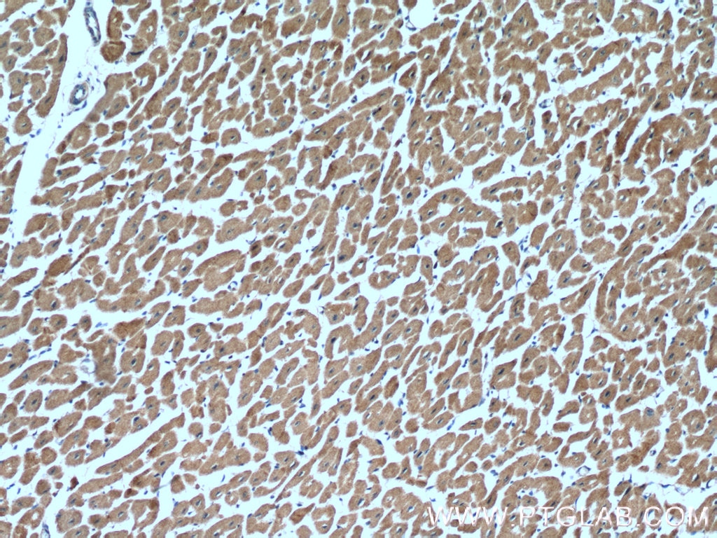 IHC staining of human heart using 12300-1-AP