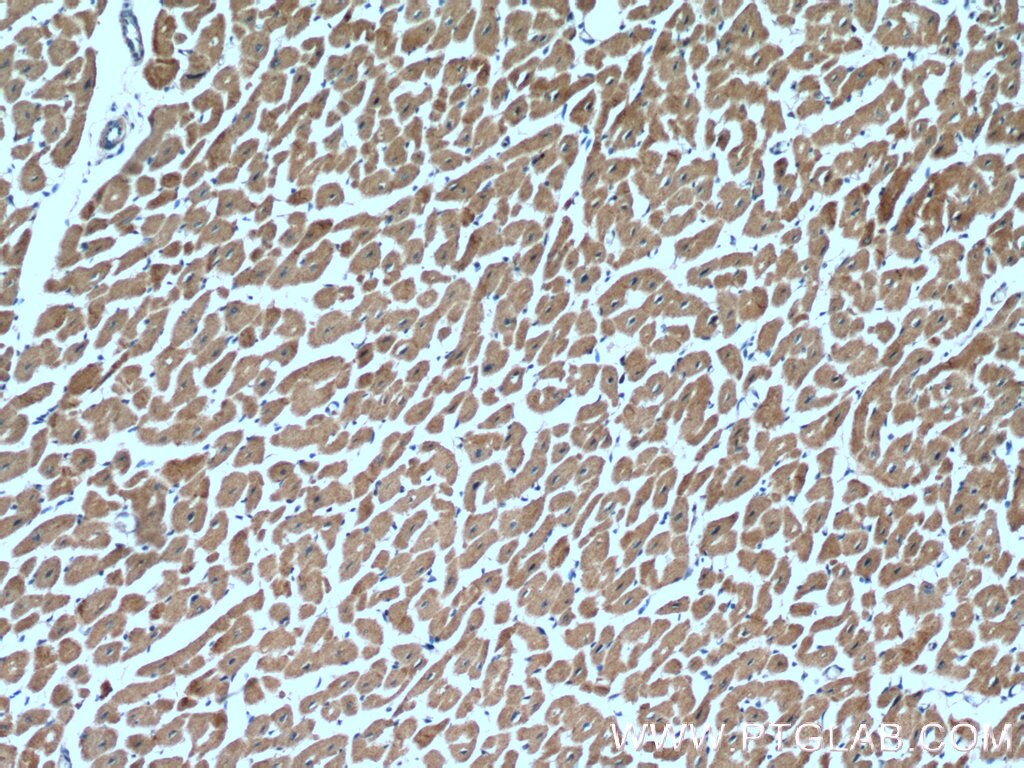 Immunohistochemistry (IHC) staining of human heart tissue using ITGB1BP1 Polyclonal antibody (12300-1-AP)