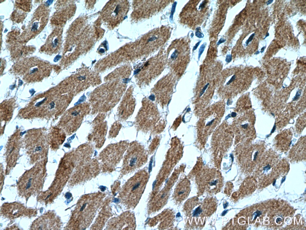 Immunohistochemistry (IHC) staining of human heart tissue using ITGB1BP1 Polyclonal antibody (12300-1-AP)