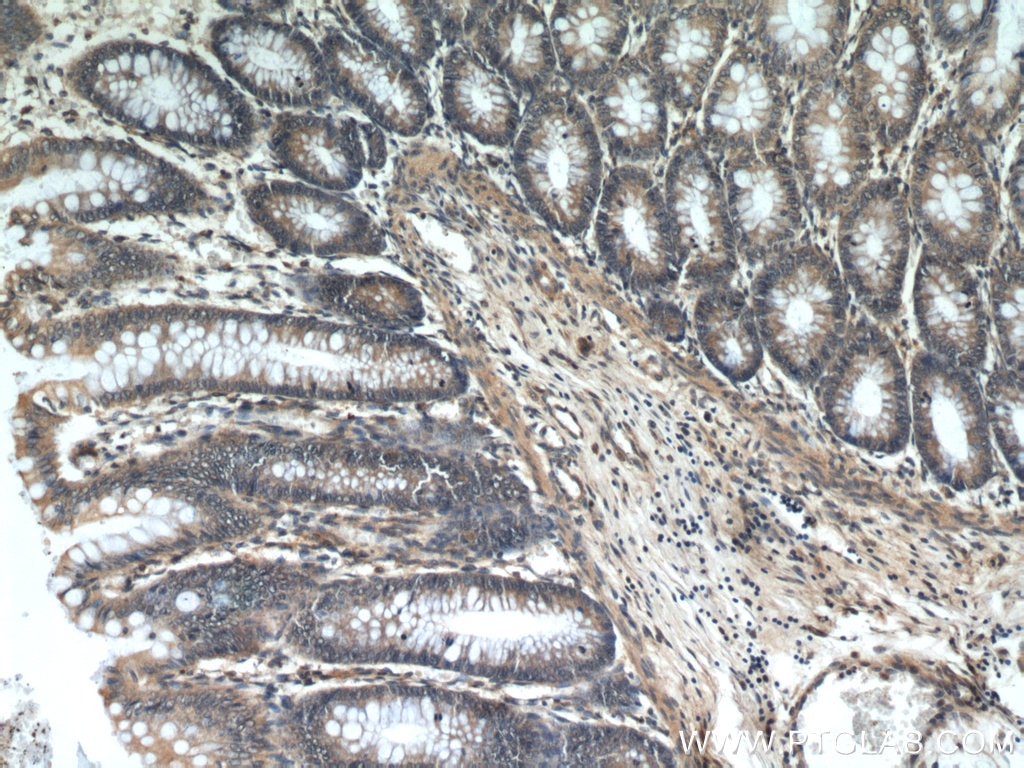 IHC staining of human colon using 12300-1-AP