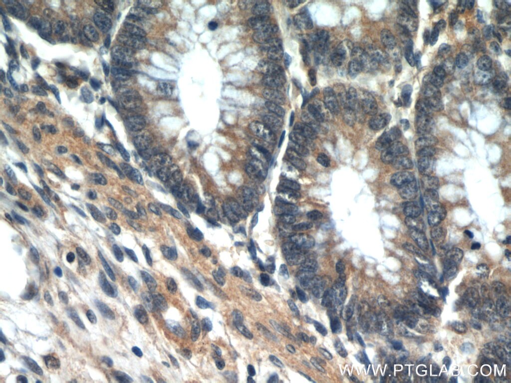 IHC staining of human colon using 12300-1-AP