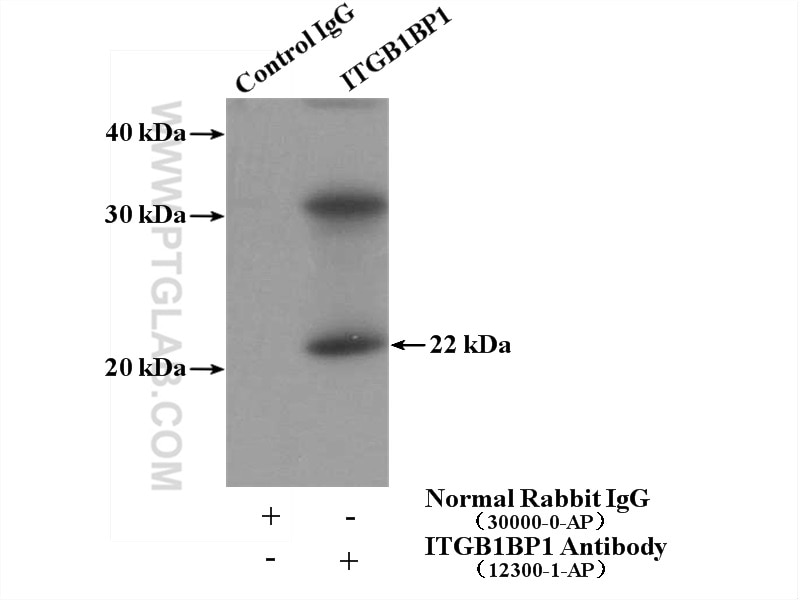 Immunoprecipitation (IP) experiment of mouse thymus tissue using ITGB1BP1 Polyclonal antibody (12300-1-AP)