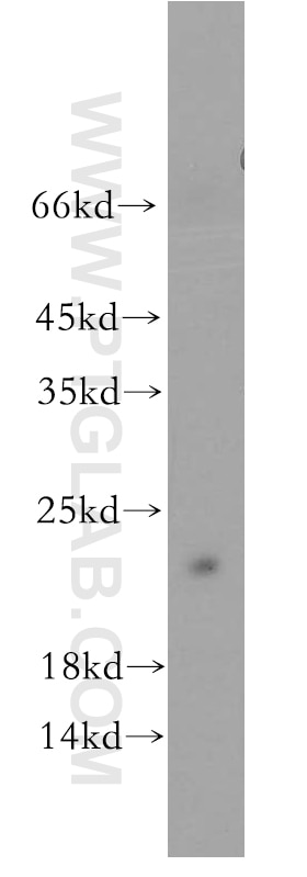 Western Blot (WB) analysis of human brain tissue using ITGB1BP1 Polyclonal antibody (12300-1-AP)