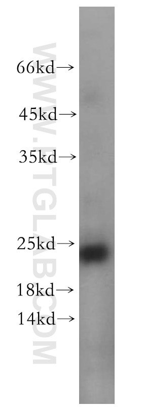 Western Blot (WB) analysis of mouse thymus tissue using ITGB1BP1 Polyclonal antibody (12300-1-AP)