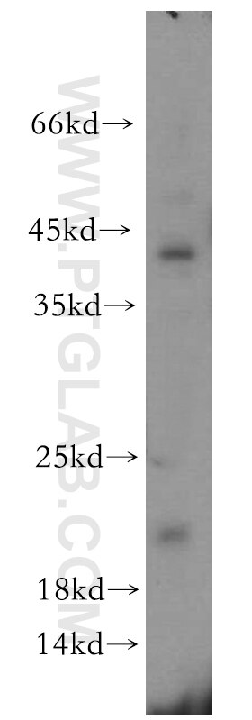 Western Blot (WB) analysis of PC-3 cells using ITGB1BP1 Polyclonal antibody (12300-1-AP)