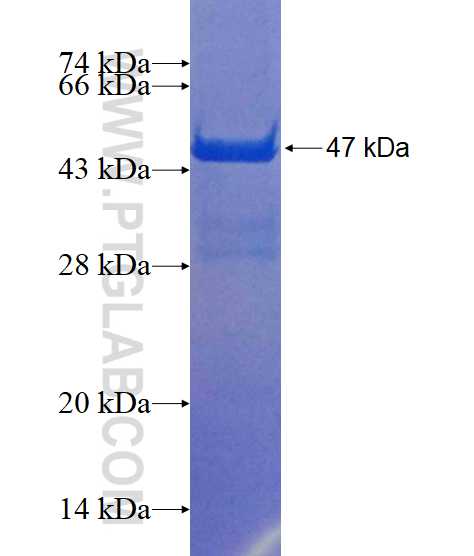 ITGB1BP1 fusion protein Ag2945 SDS-PAGE