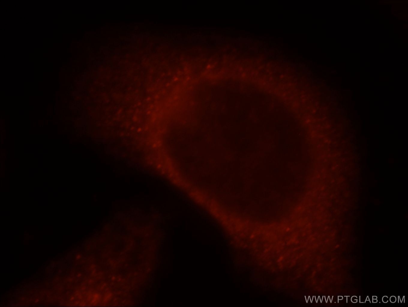 IF Staining of HepG2 using 21359-1-AP