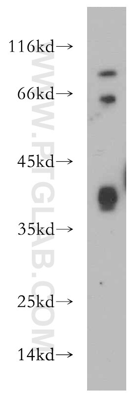 Western Blot (WB) analysis of human heart tissue using ITGB1BP2 Polyclonal antibody (21359-1-AP)
