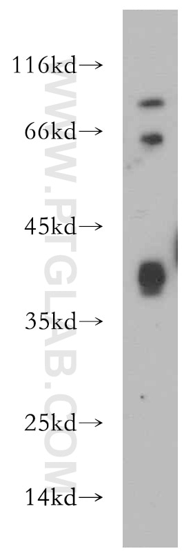 WB analysis of human heart using 21359-1-AP