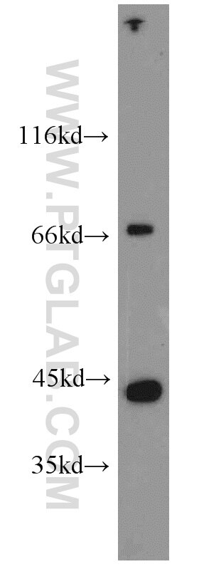 Western Blot (WB) analysis of human heart tissue using ITGB1BP2 Polyclonal antibody (21359-1-AP)