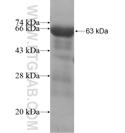 ITGB1BP2 fusion protein Ag15808 SDS-PAGE