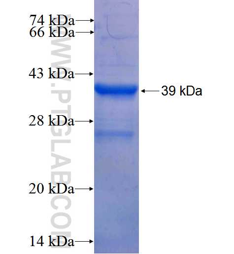 ITGB1BP3 fusion protein Ag26279 SDS-PAGE