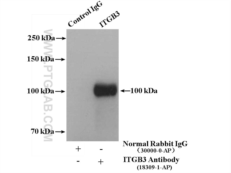 Immunoprecipitation (IP) experiment of mouse spleen tissue using Integrin Beta 3 Polyclonal antibody (18309-1-AP)
