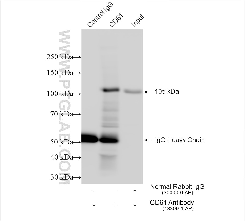 Immunoprecipitation (IP) experiment of mouse spleen tissue using CD61 / Integrin Beta 3 Polyclonal antibody (18309-1-AP)