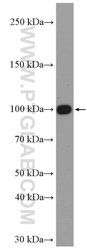 Western Blot (WB) analysis of mouse spleen tissue using CD61 / Integrin Beta 3 Polyclonal antibody (18309-1-AP)