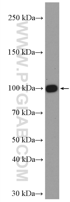 WB analysis of mouse spleen using 18309-1-AP