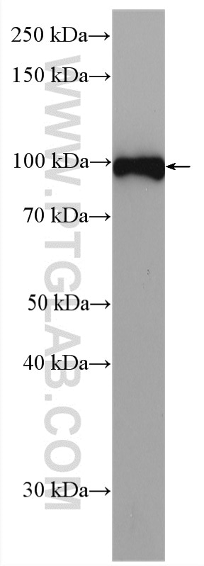 Western Blot (WB) analysis of rat spleen tissue using CD61 / Integrin Beta 3 Polyclonal antibody (18309-1-AP)