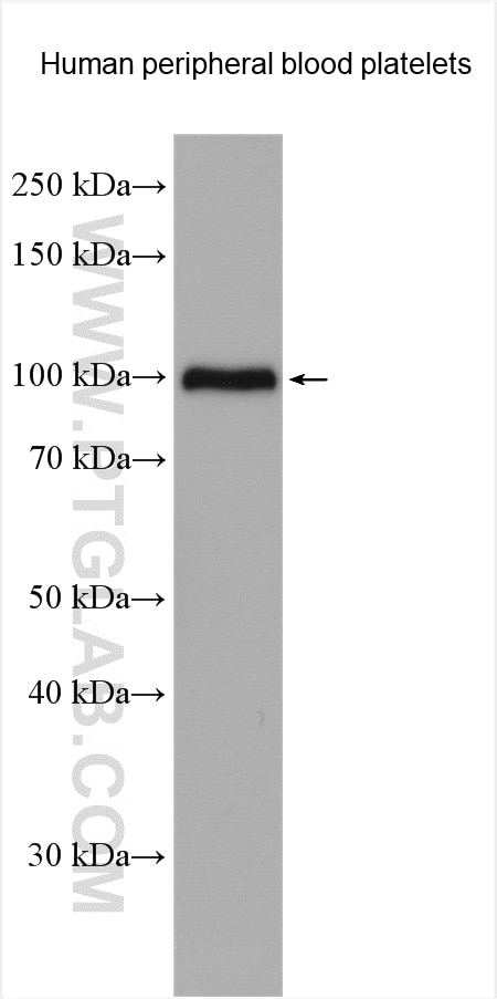Western Blot (WB) analysis of various lysates using Integrin Beta 3 Polyclonal antibody (18309-1-AP)