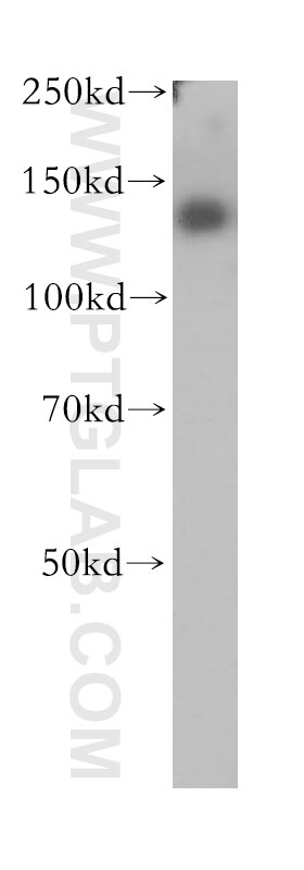 CD61 / Integrin Beta 3 Polyclonal antibody