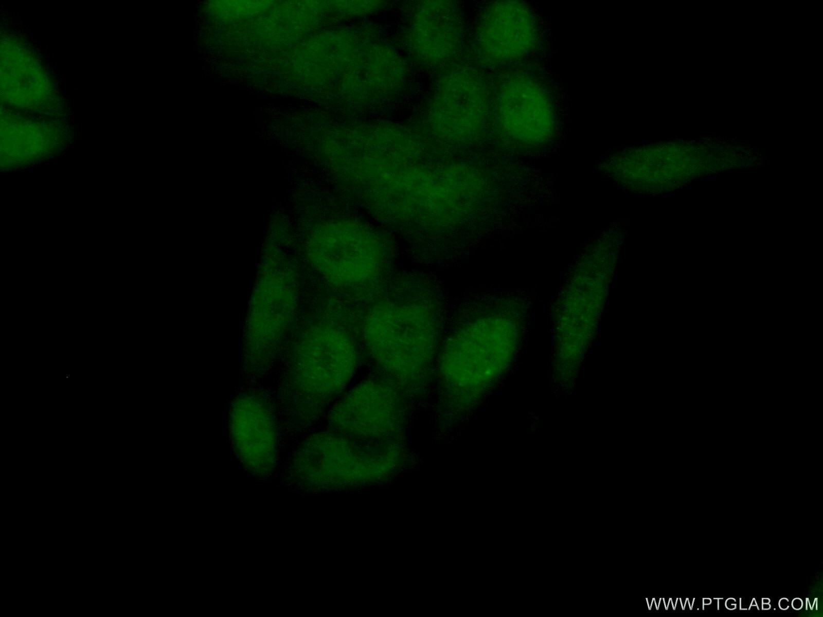 Immunofluorescence (IF) / fluorescent staining of HeLa cells using Centromere protein R Polyclonal antibody (10743-1-AP)