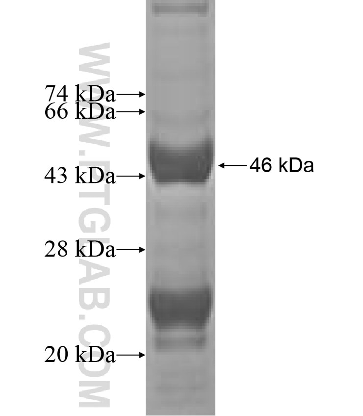 Centromere protein R fusion protein Ag1204 SDS-PAGE