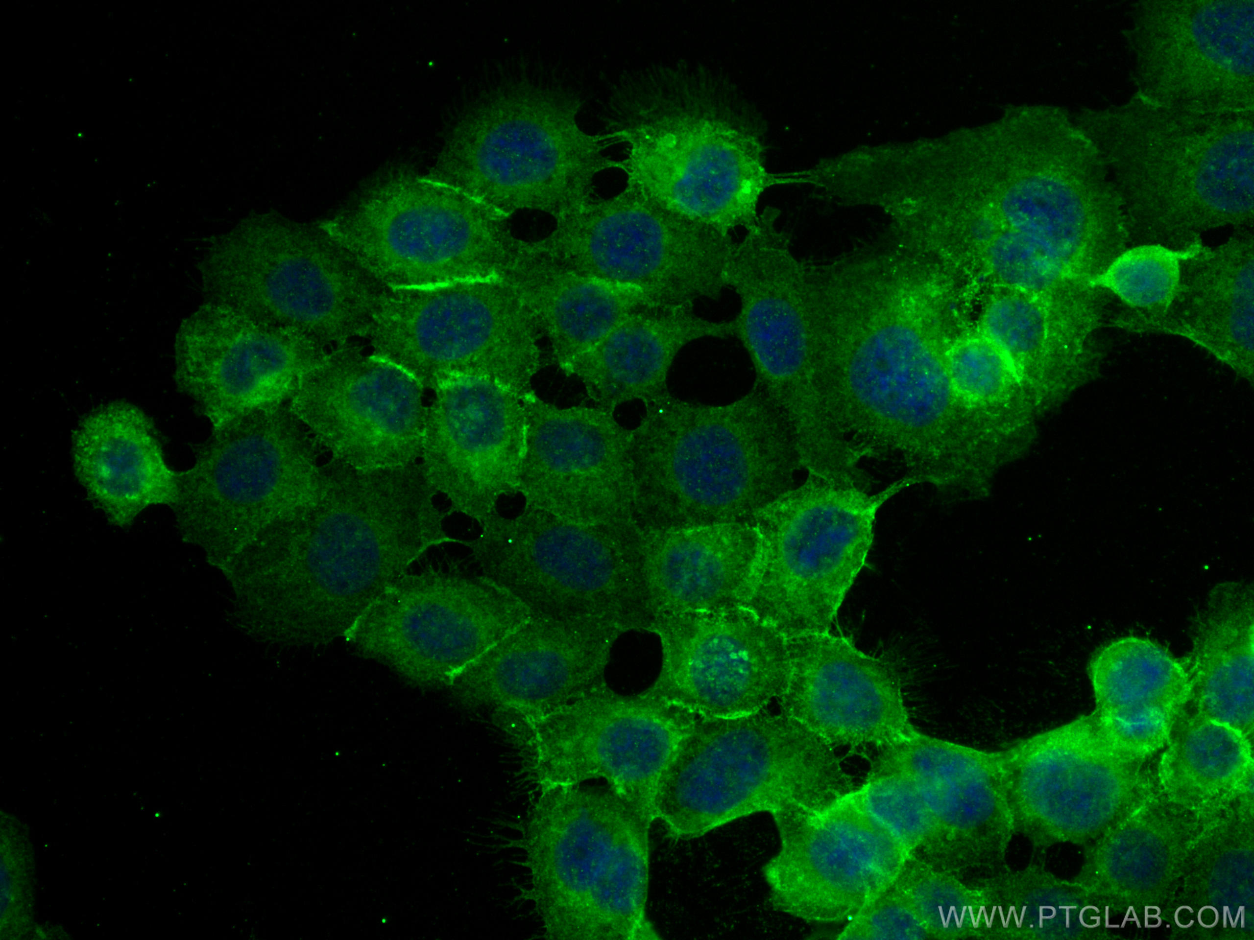 Immunofluorescence (IF) / fluorescent staining of A431 cells using Integrin Beta 4 Polyclonal antibody (21738-1-AP)