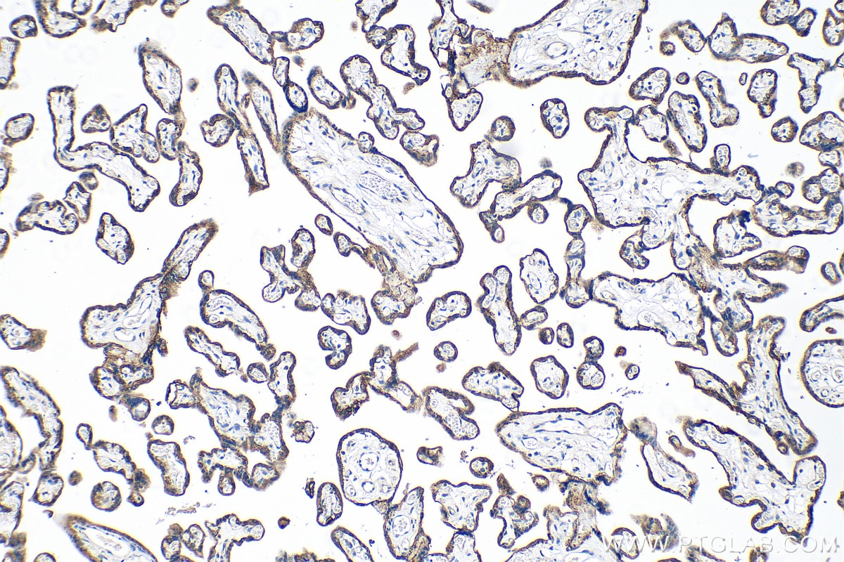 Immunohistochemistry (IHC) staining of human placenta tissue using Integrin Beta 4 Polyclonal antibody (21738-1-AP)
