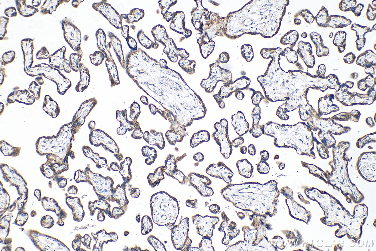 IHC staining of human placenta using 21738-1-AP