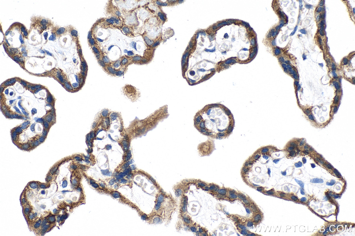 Immunohistochemistry (IHC) staining of human placenta tissue using Integrin Beta 4 Polyclonal antibody (21738-1-AP)