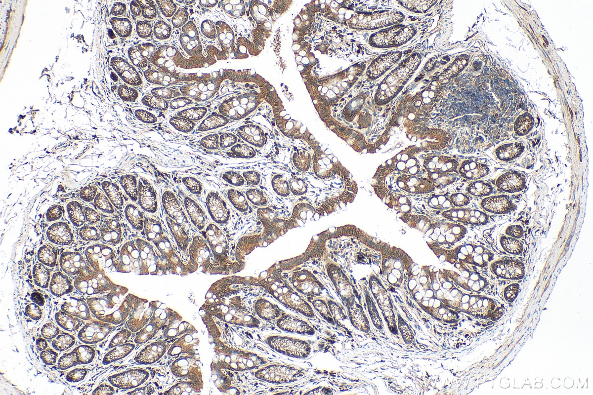 Immunohistochemistry (IHC) staining of mouse colon tissue using Integrin Beta 4 Polyclonal antibody (21738-1-AP)