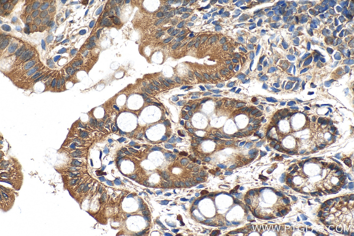 Immunohistochemistry (IHC) staining of mouse colon tissue using Integrin Beta 4 Polyclonal antibody (21738-1-AP)