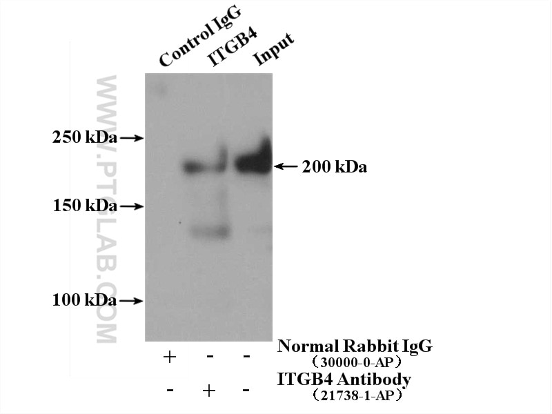 Immunoprecipitation (IP) experiment of HeLa cells using Integrin Beta 4 Polyclonal antibody (21738-1-AP)