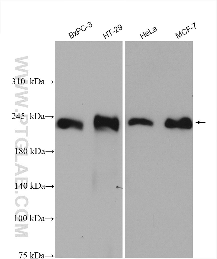 Western Blot (WB) analysis of various lysates using Integrin Beta 4 Polyclonal antibody (21738-1-AP)