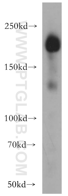 Western Blot (WB) analysis of A431 cells using Integrin Beta 4 Polyclonal antibody (21738-1-AP)