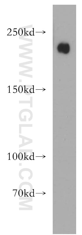 Western Blot (WB) analysis of A549 cells using Integrin Beta 4 Polyclonal antibody (21738-1-AP)