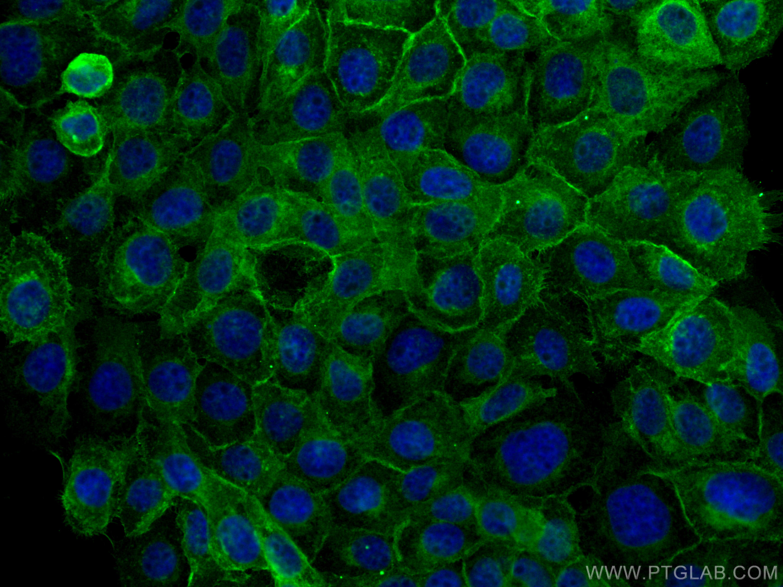 Immunofluorescence (IF) / fluorescent staining of A431 cells using Integrin Beta 4 Polyclonal antibody (25277-1-AP)