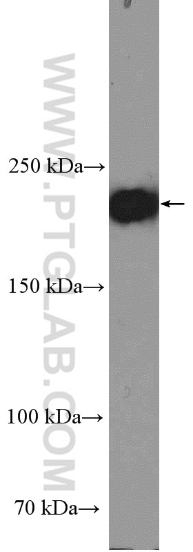 Western Blot (WB) analysis of BxPC-3 cells using Integrin Beta 4 Polyclonal antibody (25277-1-AP)