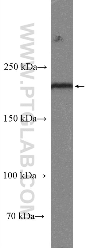 Western Blot (WB) analysis of rat skin tissue using Integrin Beta 4 Polyclonal antibody (25277-1-AP)