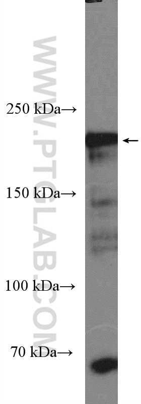 Western Blot (WB) analysis of mouse pancreas tissue using Integrin Beta 4 Polyclonal antibody (25277-1-AP)