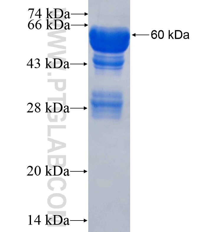 ITGB4 fusion protein Ag16460 SDS-PAGE