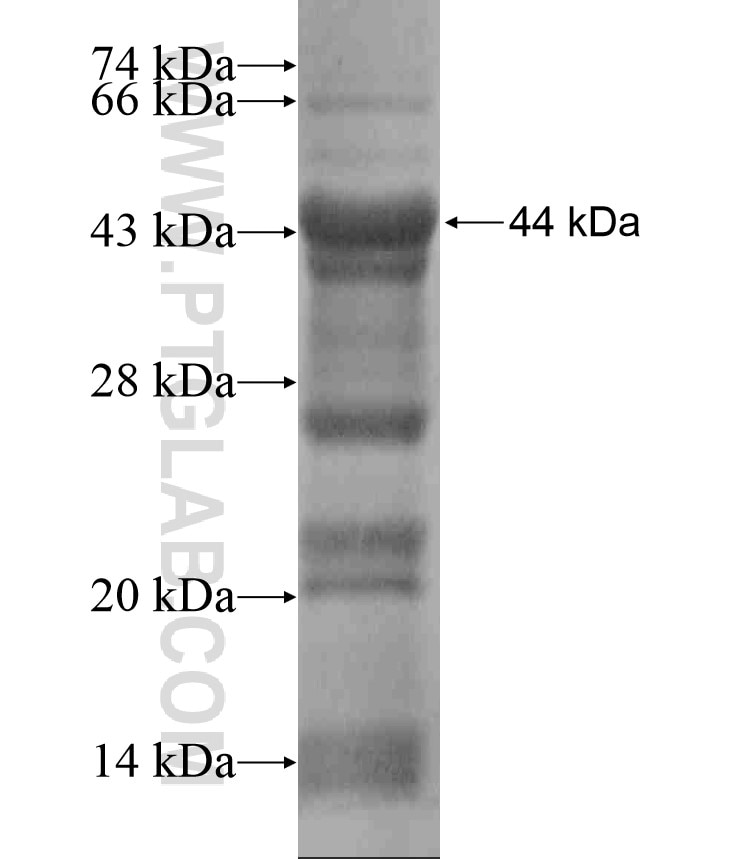 ITGB4 fusion protein Ag17396 SDS-PAGE