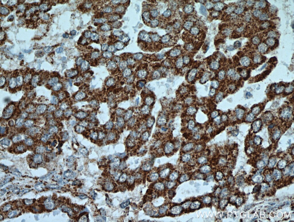 Integrin Beta 6 Polyclonal antibody