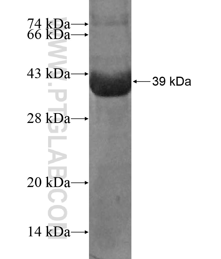 Integrin beta-6 fusion protein Ag17394 SDS-PAGE