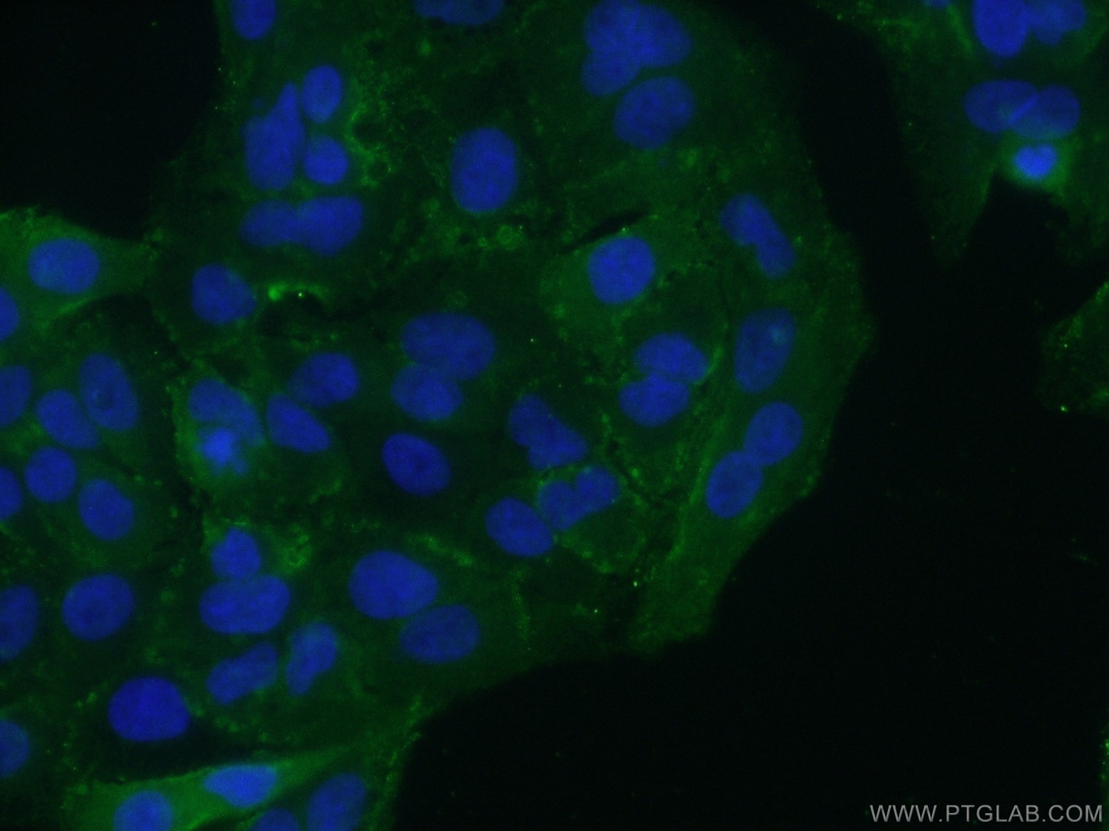 Immunofluorescence (IF) / fluorescent staining of A549 cells using Integrin beta-6-Specific Polyclonal antibody (19695-1-AP)