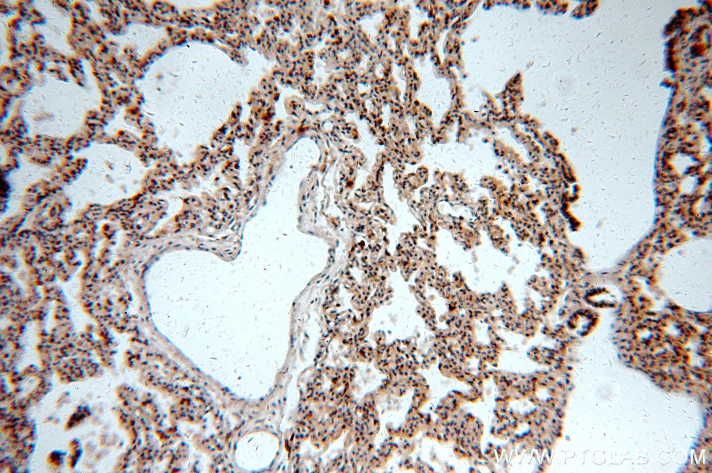 Immunohistochemistry (IHC) staining of human lung tissue using Integrin beta-6-Specific Polyclonal antibody (19695-1-AP)