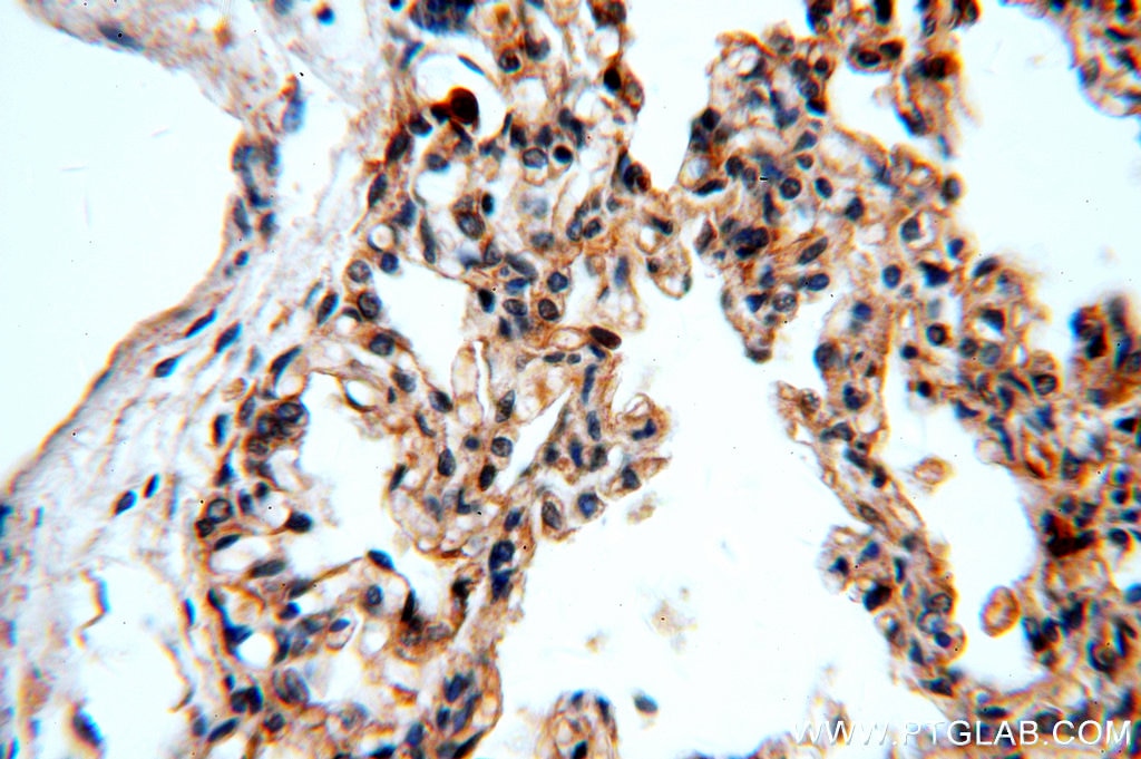 Immunohistochemistry (IHC) staining of human lung tissue using Integrin beta-6-Specific Polyclonal antibody (19695-1-AP)