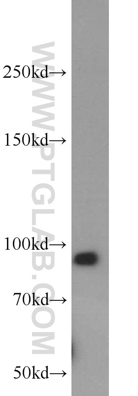 Western Blot (WB) analysis of A549 cells using Integrin beta-6-Specific Polyclonal antibody (19695-1-AP)